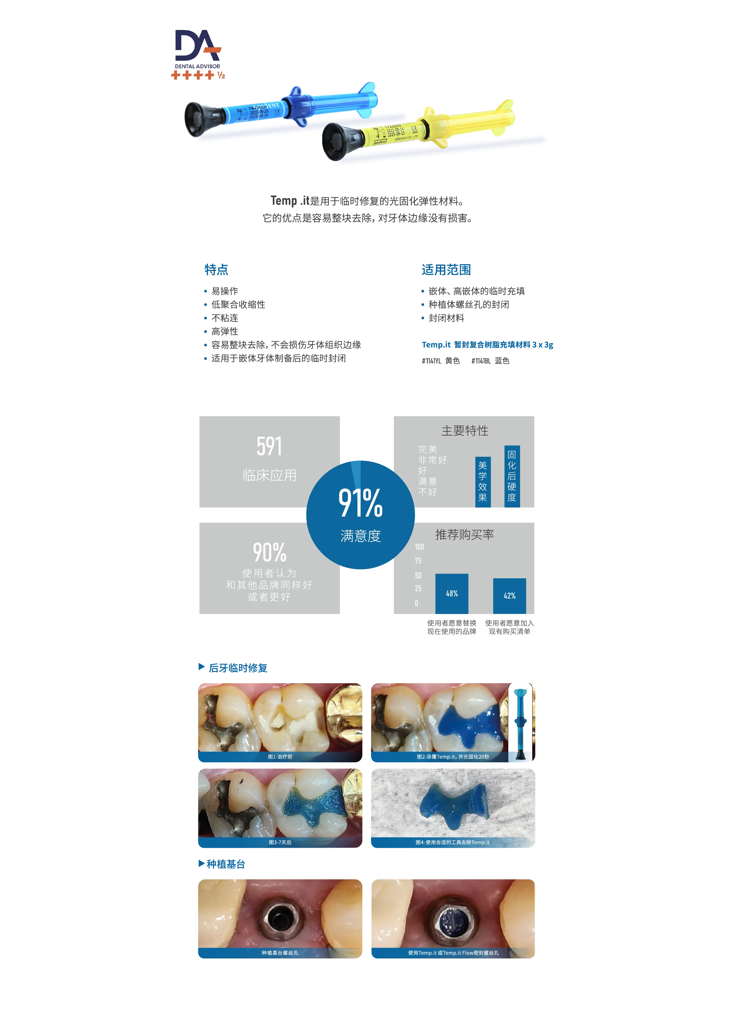 Onlay Solution (1).webp